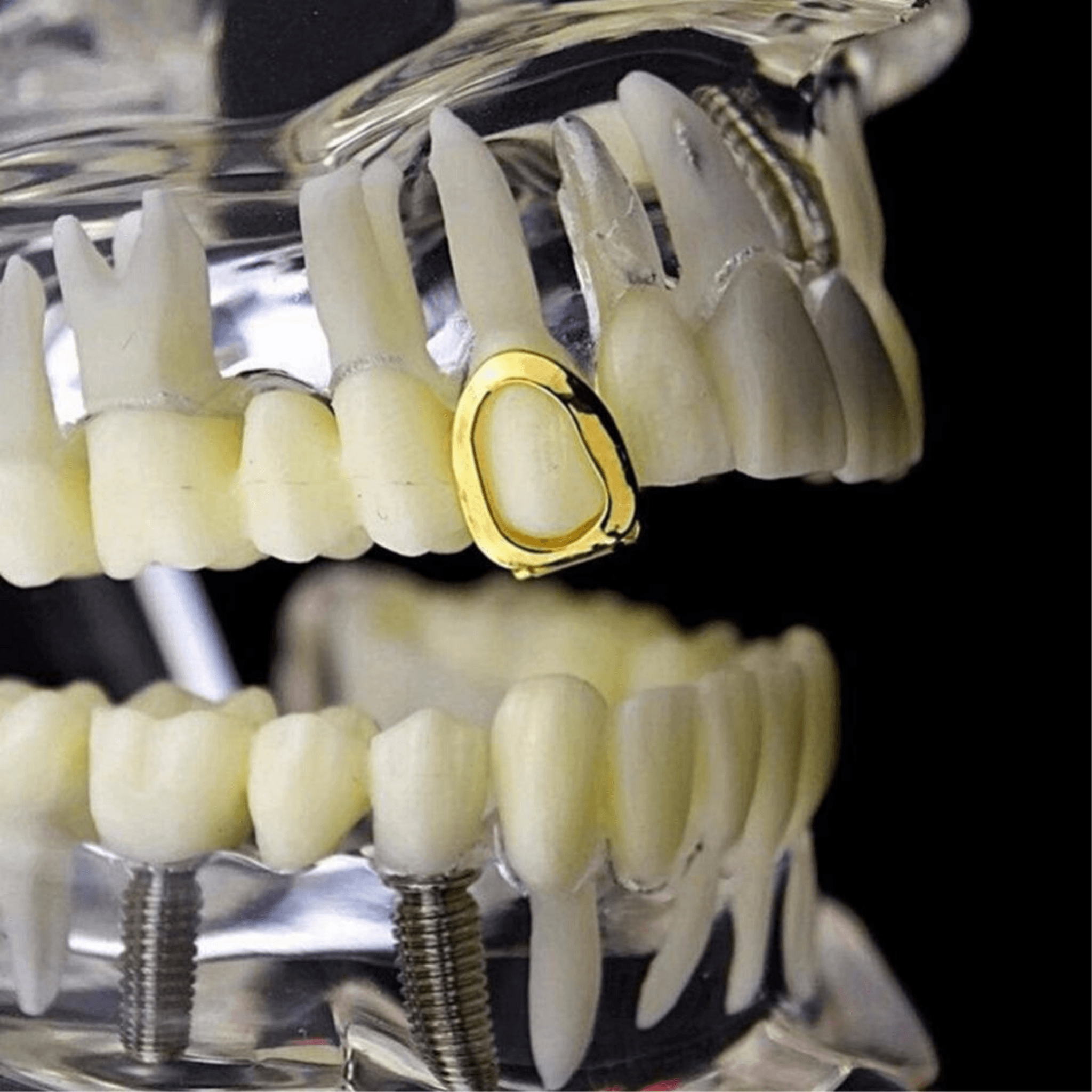 CANINE OPEN FACE SINGLE CAP GRILLZ 14K - ICECI